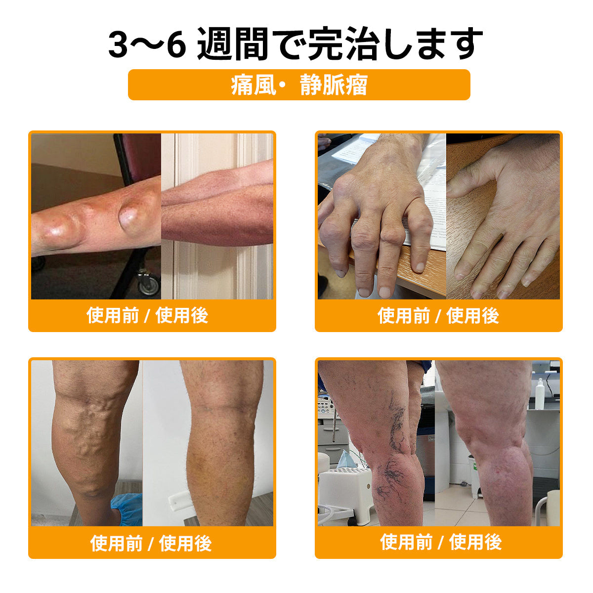 🎁 残り 5 箱限定！追加 30％OFF！健康的な体へ。今逃すと来年まで再開なし